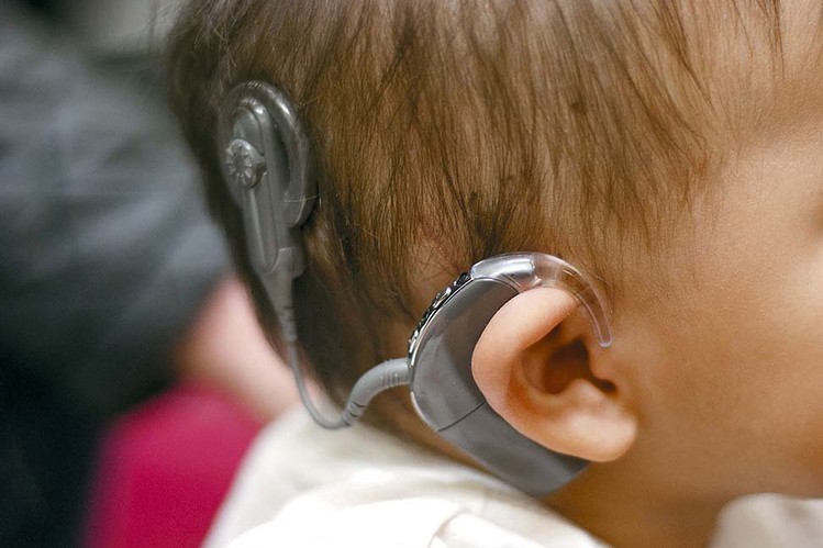 В Тверской области введена новая мера поддержки для людей с нарушениями слуха